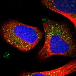 eIF5A2 Antibody, Novus Biologicals:Antibodies:Primary Antibodies